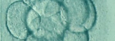 Over Two Million Human Embryos Have Been Killed in the UK in IVF Since 1990